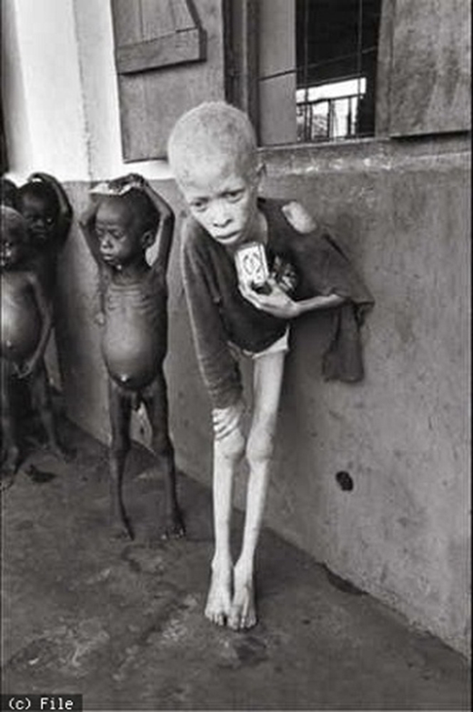 
	
	Đây là bức ảnh của bộ tộc Igbo. Trong cuộc chiến tranh ở Nigeria, hầu như những người trong bộ tộc này đã chết vì nạn đói trong suốt cuộc chiến. Tấm ảnh được chụp bởi nhiếp ảnh gia Don Mcculin này đã báo động tình trạng nghiêm trọng của nạn đói ở Nigeria ngay thời điểm hiện tại.
